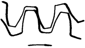 �X݆�����g(sh��)�Z(y��)һ�㶨�x