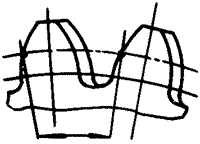 �X݆�����g(sh��)�Z(y��)�A���X݆�͈A���X݆��