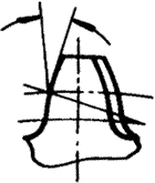 �X݆�����g(sh��)�Z(y��)�A���X݆�͈A���X݆��